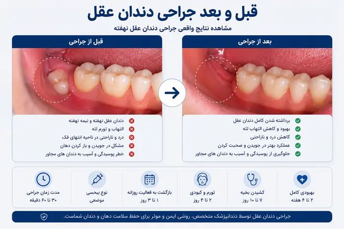 قبل و بعد جراحی دندان عقل