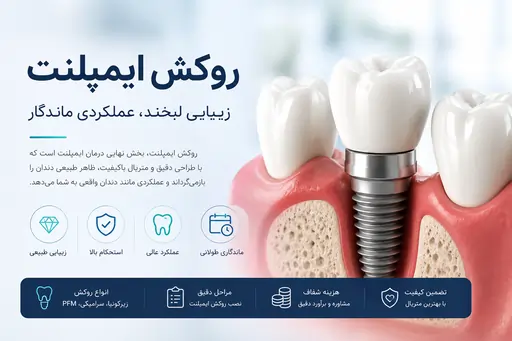 روکش ایمپلنت