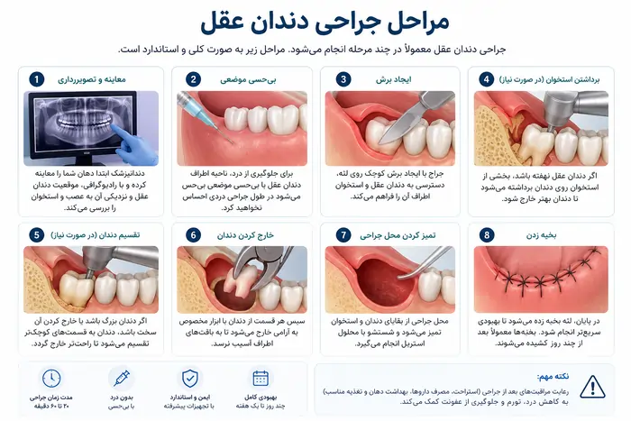 مراحل جراحی دندان عقل