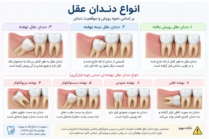 انواع دندان عقل نهفته نیمه نهفته و رویش یافته
