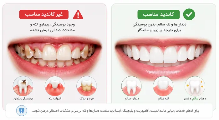 کاندیدای مناسب خدمات زیبایی دندانپزشکی