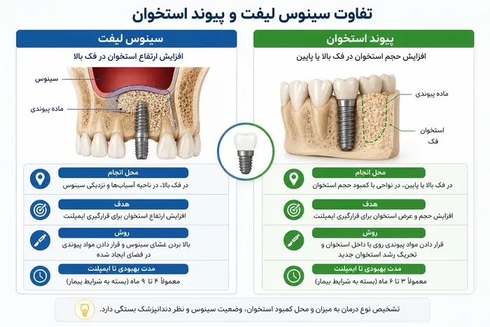 تفاوت سینوس لیفت و پیوند استخوان