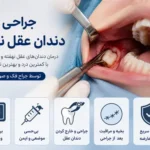 جراحی دندان عقل