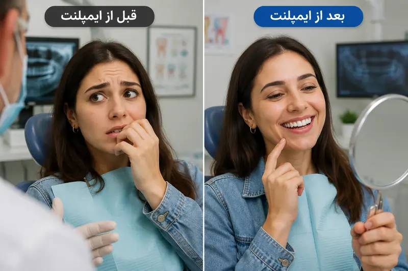 ترس از ایمپلنت دندان