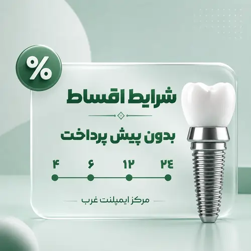 ایمپلنت قسطی در تهران