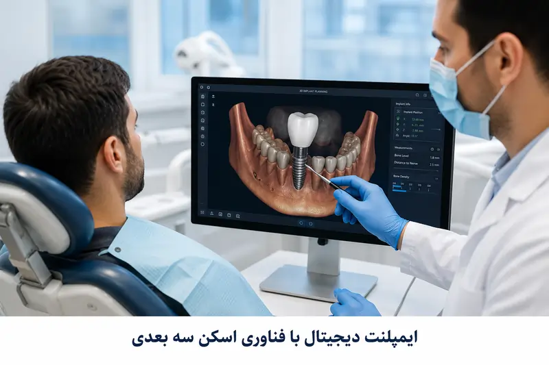 ایمپلنت دیجیتال چیست؟ مزایا، مراحل، هزینه و ماندگاری در ۱۴۰۵ 1 ایمپلنت دیجیتال با فناوری اسکن سه بعدی