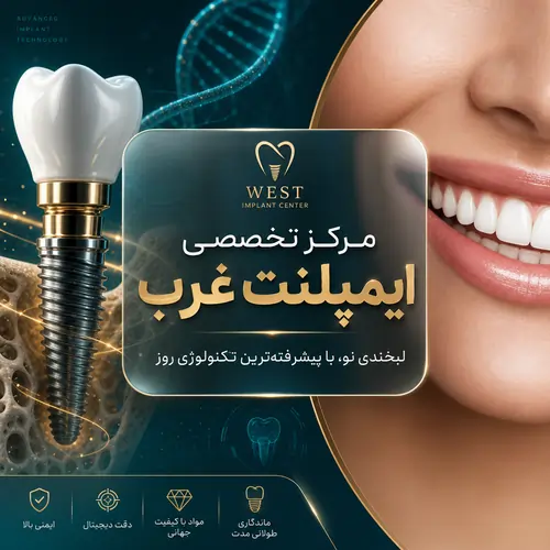 مرکز ایمپلنت غرب
