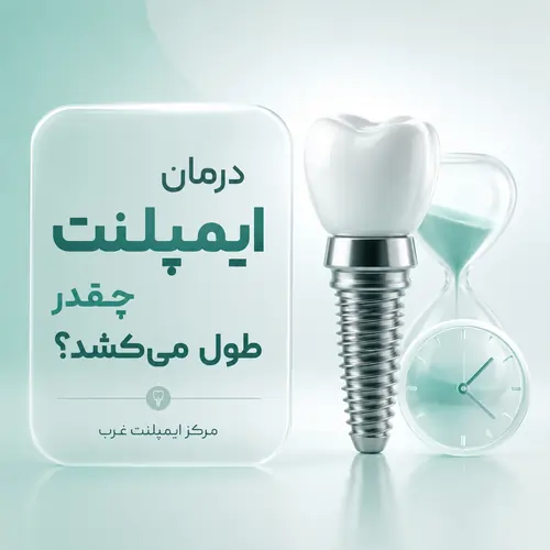 ایمپلنت چقدر طول می کشه؟