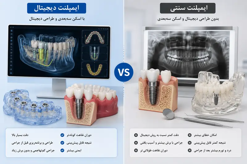 ایمپلنت دیجیتال چیست؟ مزایا، مراحل، هزینه و ماندگاری در ۱۴۰۵ 2 تفاوت ایمپلنت دیجیتال و ایمپلنت معمولی