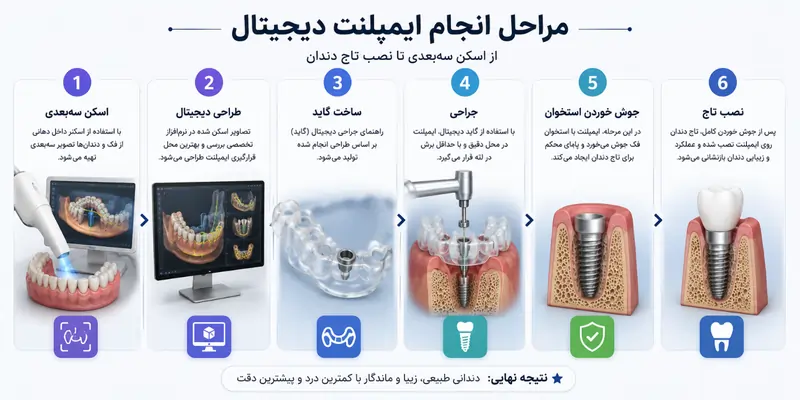ایمپلنت دیجیتال چیست؟ مزایا، مراحل، هزینه و ماندگاری در ۱۴۰۵ 3 مراحل انجام ایمپلنت دیجیتال