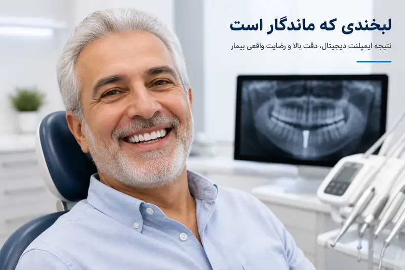 ایمپلنت دیجیتال چیست؟ مزایا، مراحل، هزینه و ماندگاری در ۱۴۰۵ 7 نتیجه ایمپلنت دندان