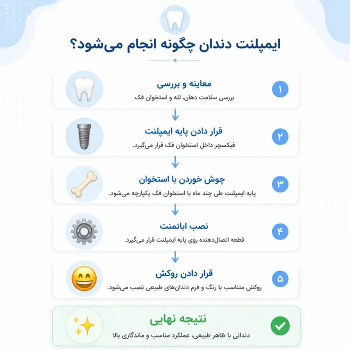 ایمپلنت دندان چیست؟ راهنمای کامل آشنایی با مراحل، مزایا و ماندگاری 5 مراحل انجام ایمپلنت دندان از معاینه تا نصب روکش