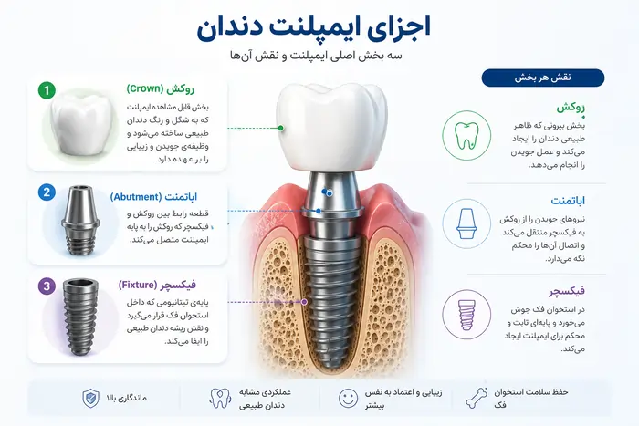 ایمپلنت دندان چیست؟ راهنمای کامل آشنایی با مراحل، مزایا و ماندگاری 3 اجزای ایمپلنت دندان و نقش فیکسچر، اباتمنت و روکش