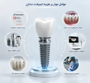 عوامل موثر بر هزینه کاشت دندان