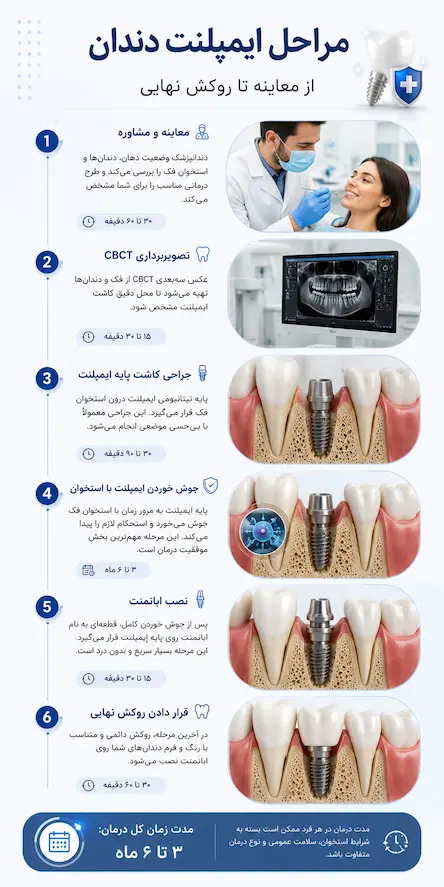 مراحل درمان ایمپلنت دندان