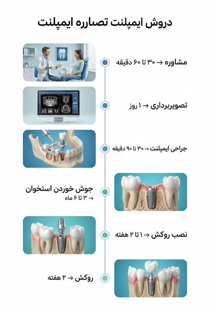 درمان ایمپلنت چقدر طول میکشد؟ راهنمای زمان بندی از جراحی تا روکش 2 مراحل و زمانبندی درمان ایمپلنت دندان