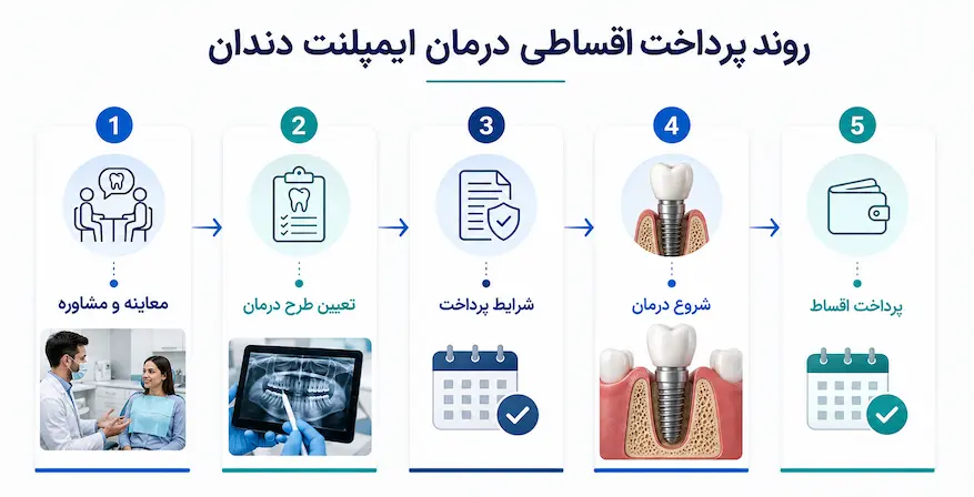 مراحل پرداخت اقساطی ایمپلنت دندان
